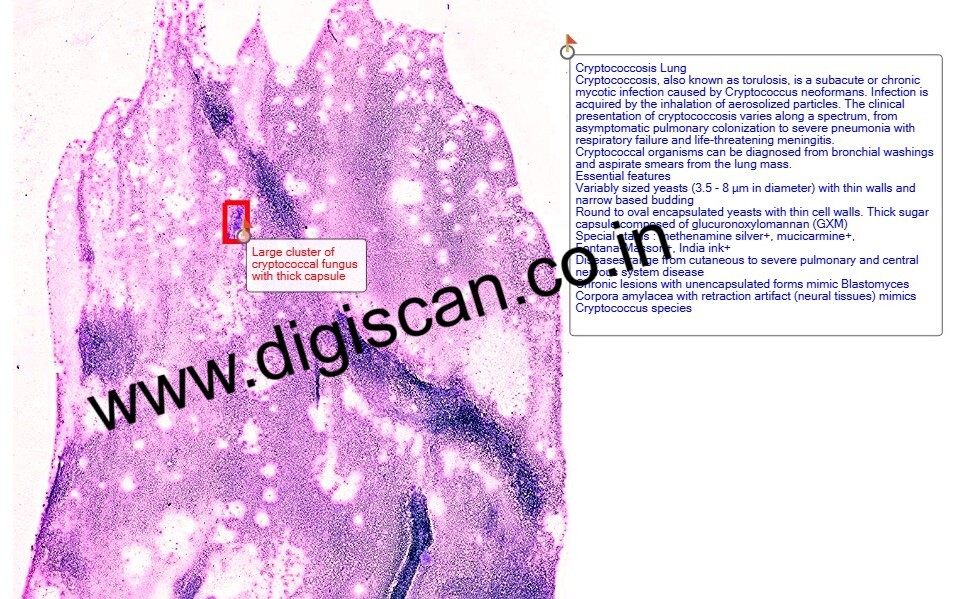 Fine Needle Aspiration Cytology (FNAC) Digital Slides Set